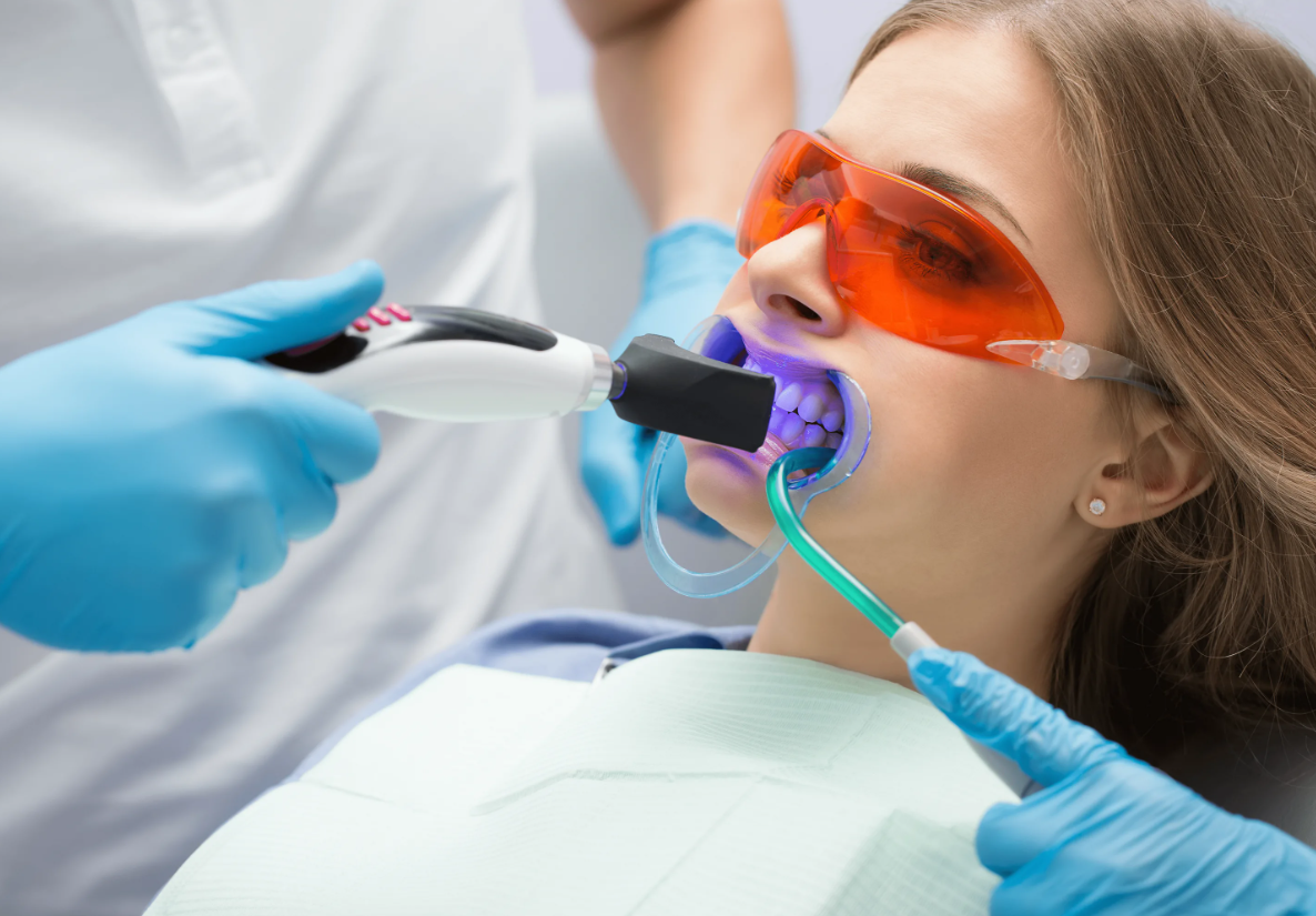 Стоматологическое отбеливание зубов. Отбеливание зубов. Отбеливание зубов лазером.